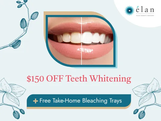 27914 tulsa teeth whitening brushing