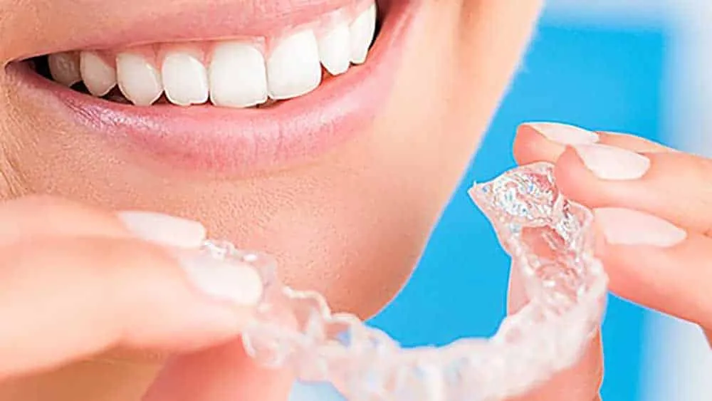 27914 tulsa teeth whitening checkup