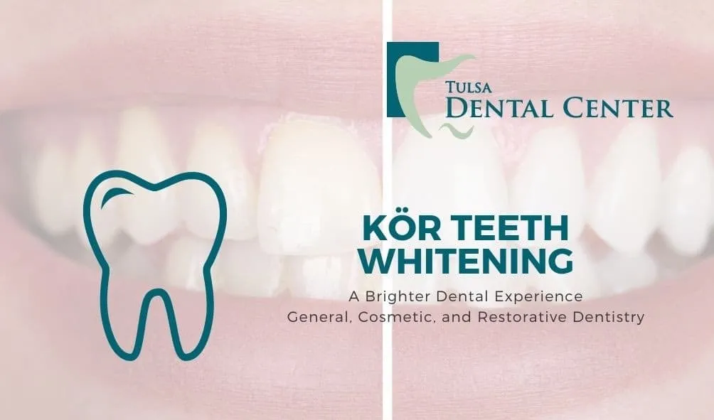 27914 tulsa teeth whitening healthy food