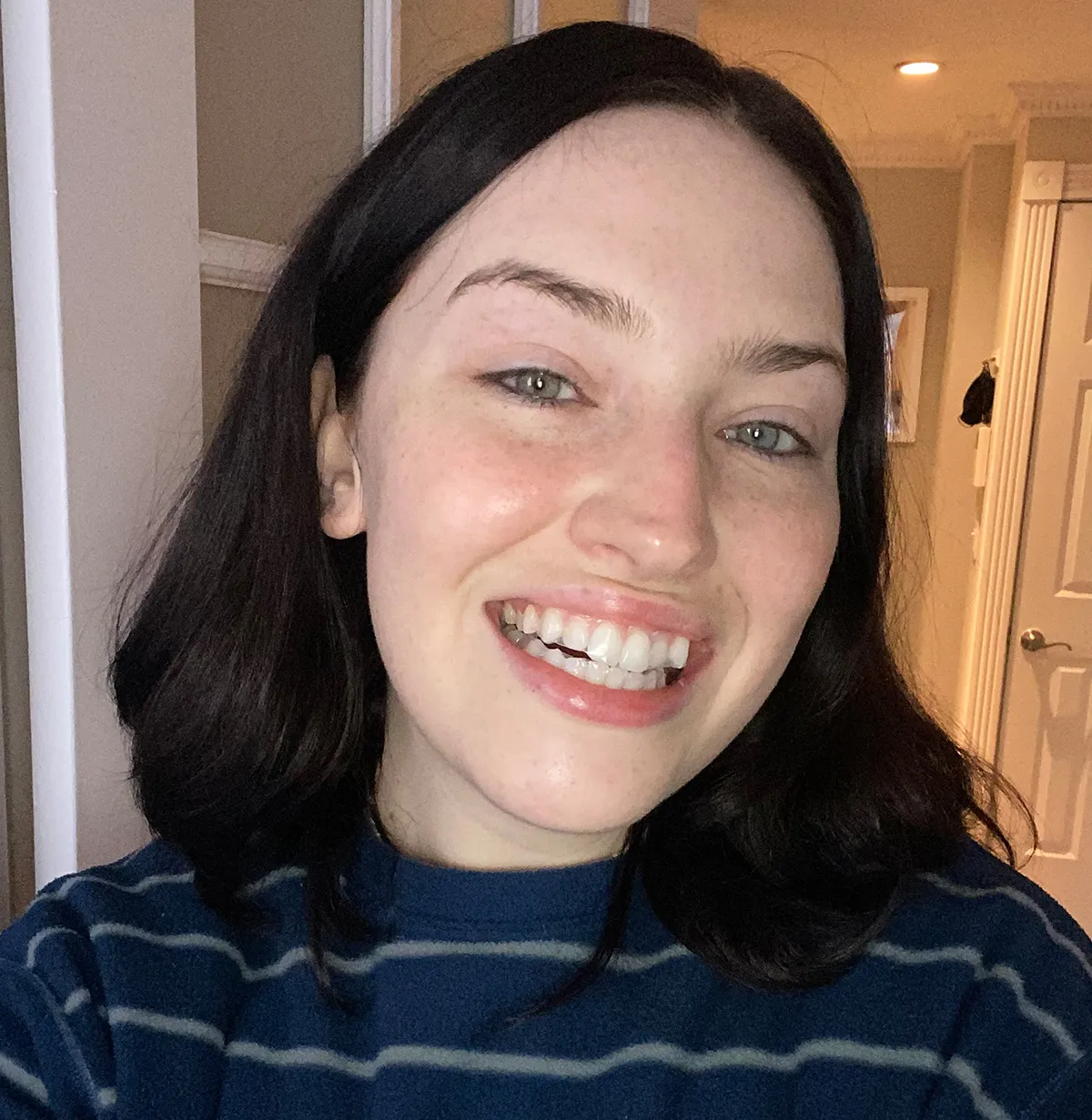 27915 smile direct whitening oral health