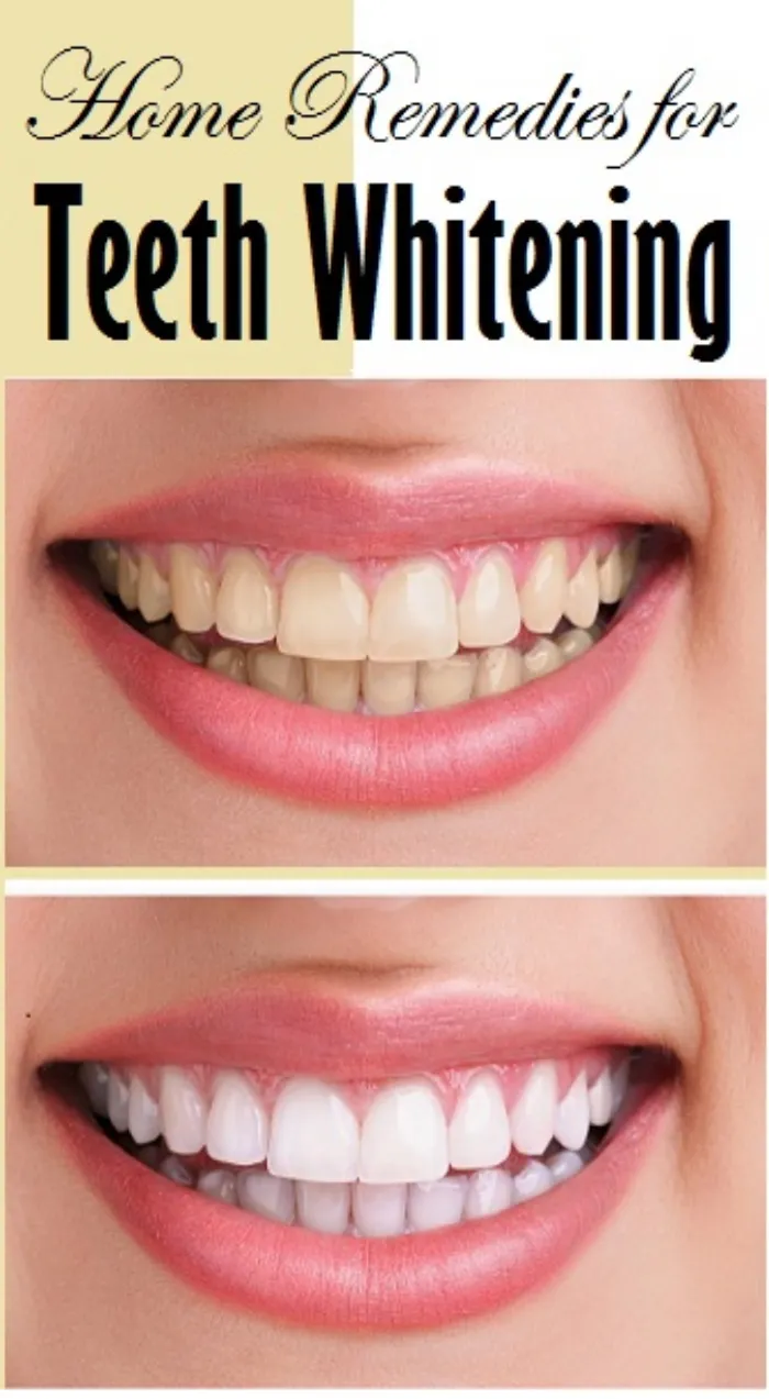 /img/27916-turmeric-teeth-whitening.webp