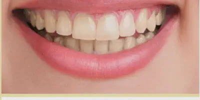 /img/27916-turmeric-teeth-whitening.webp