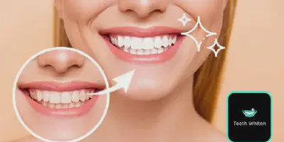 /img/27918-adobe-photoshop-express-teeth-whitening.webp