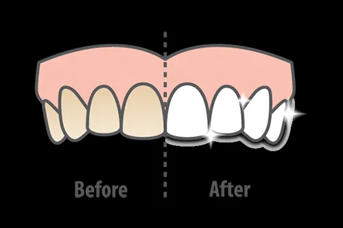 27925 foods drinks stain teeth