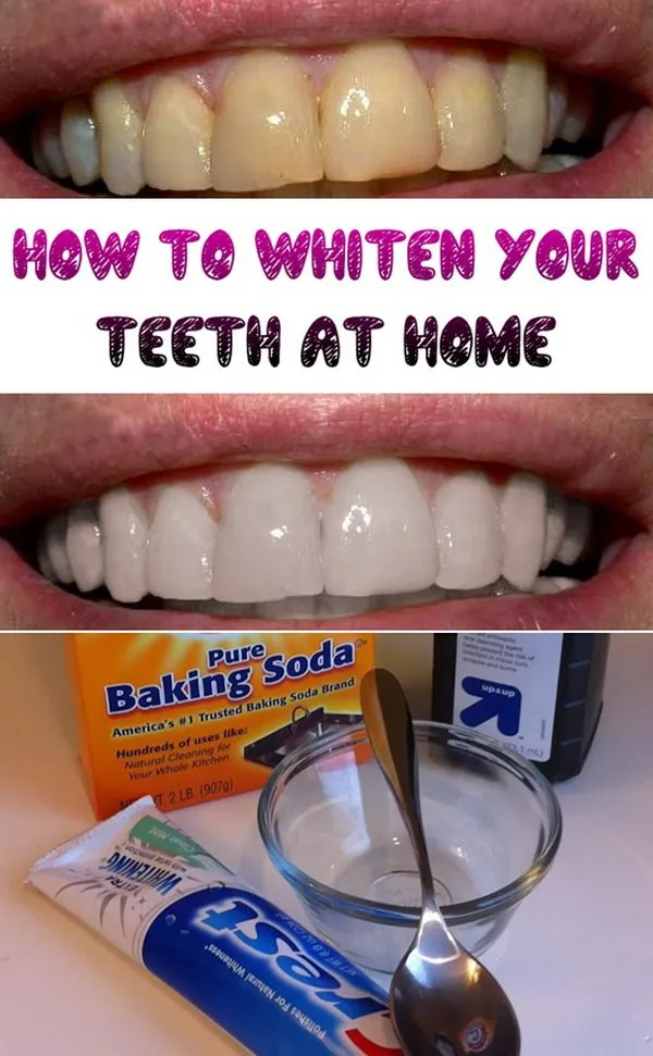 27926 oral hygiene routine