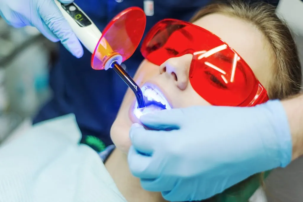 27929 in office whitening