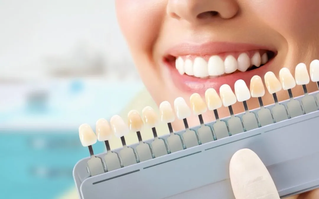27935 teeth whitening factors