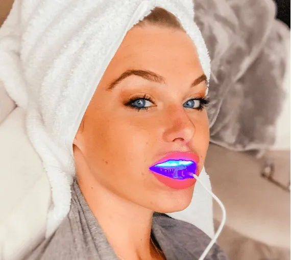 27943 teeth whitening process