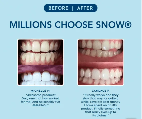27943 whitening comparison