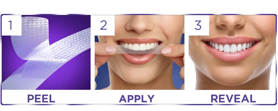 27954 preparing teeth for whitening