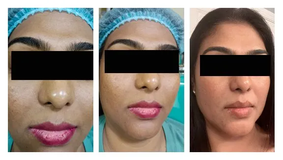 27958 confidence boost