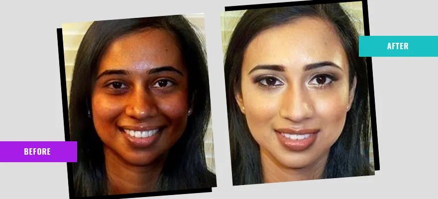 27958 skin tone enhancement