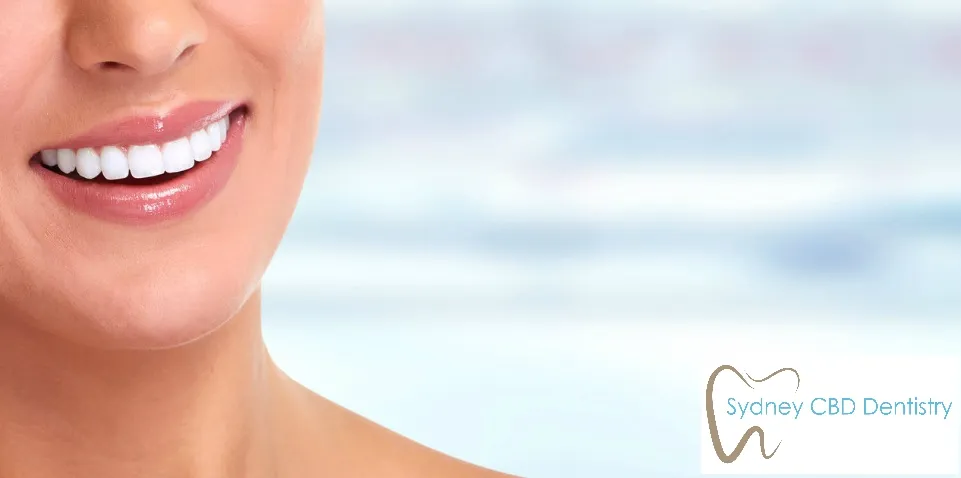 27959 take home teeth whitening kits