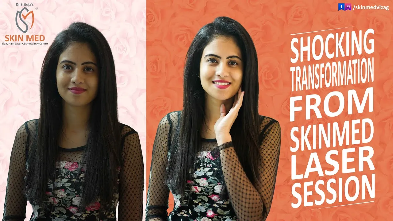 27960 dermatologist vizag consultation