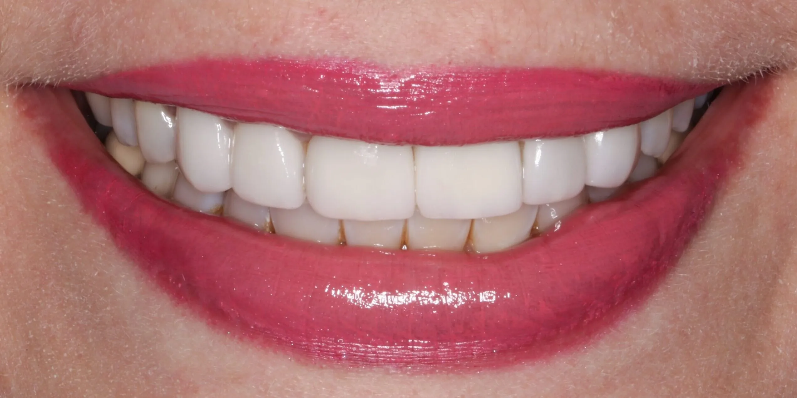27965 el paso tx dentist teeth whitening