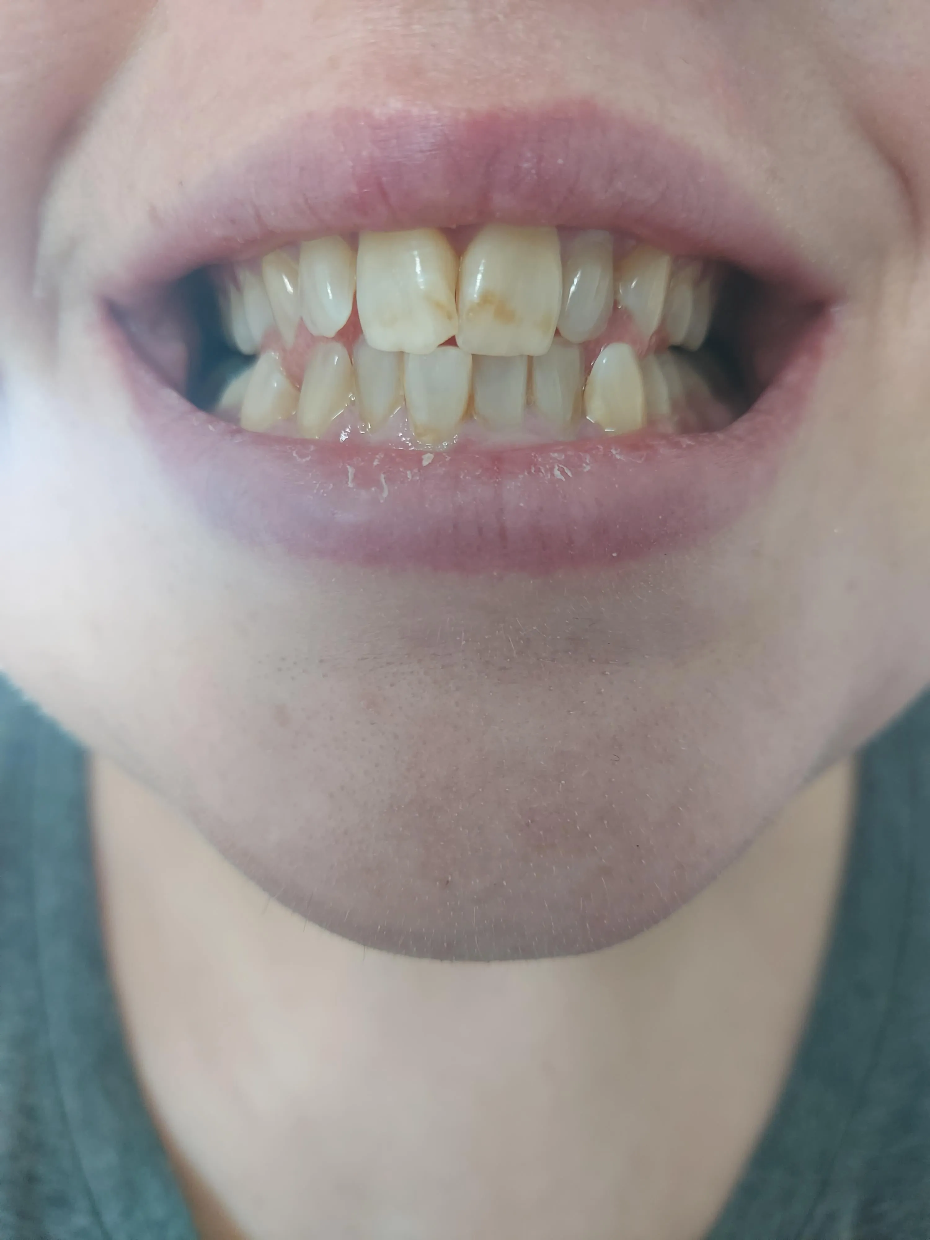 27966 smiling person