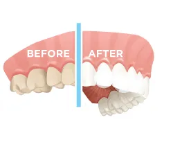 27967 teeth whitening syracuse ny image3