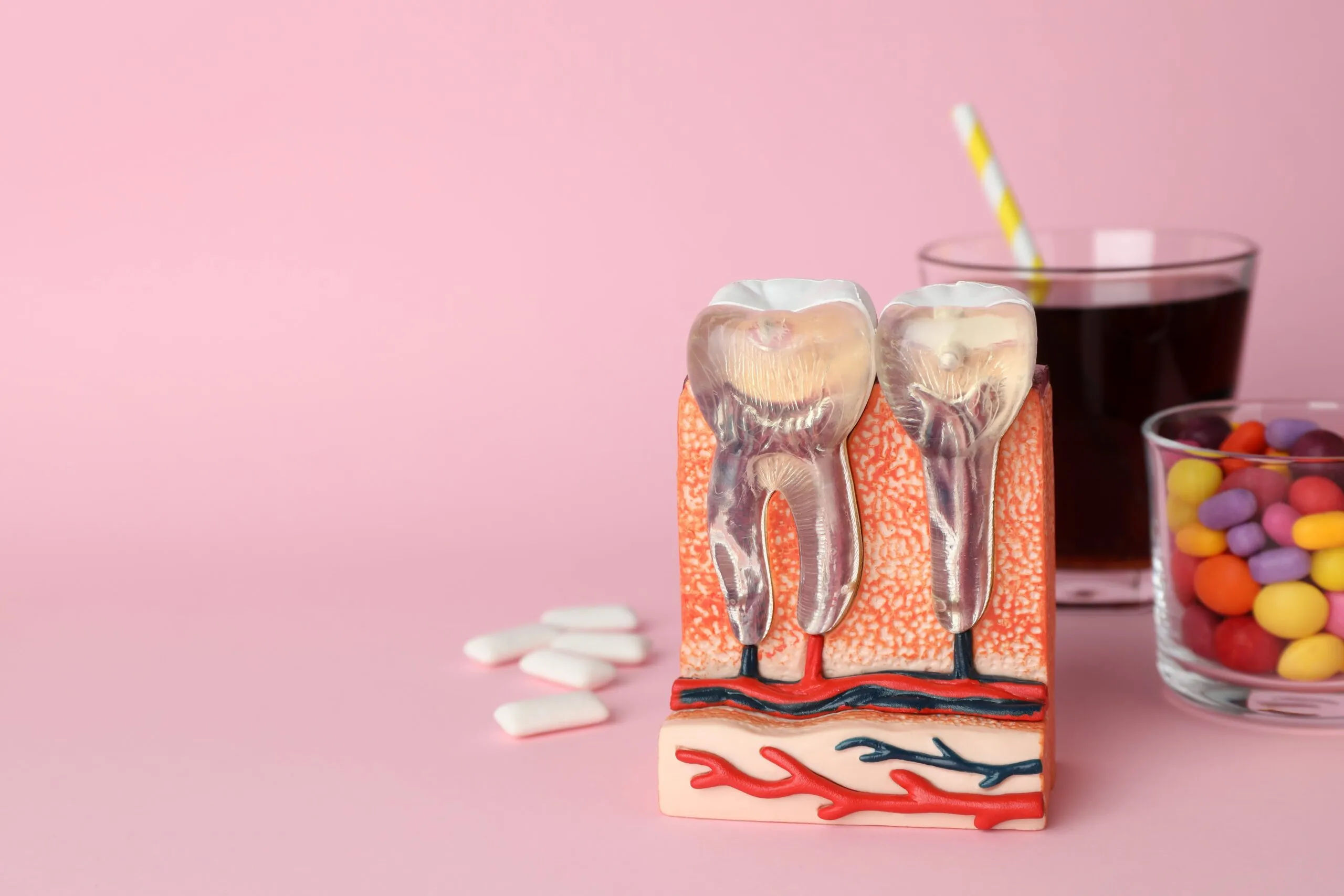 27980 teeth whitening pain 6