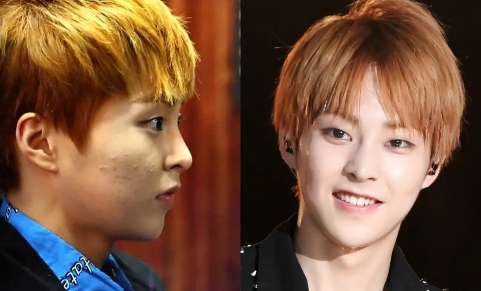 27986 kpop skin whitening 5