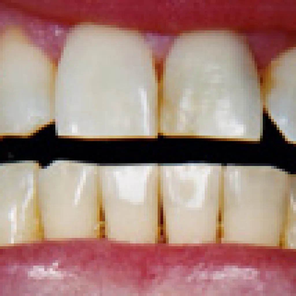 27990 sensitivity toothpaste