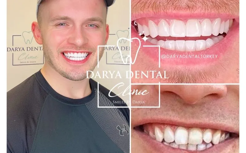 27997 strawberries whitening