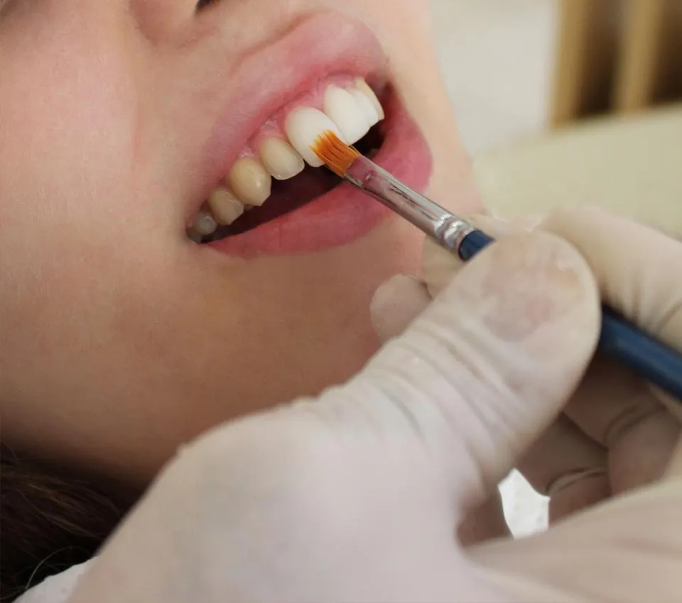 28000 teeth whitening customer review