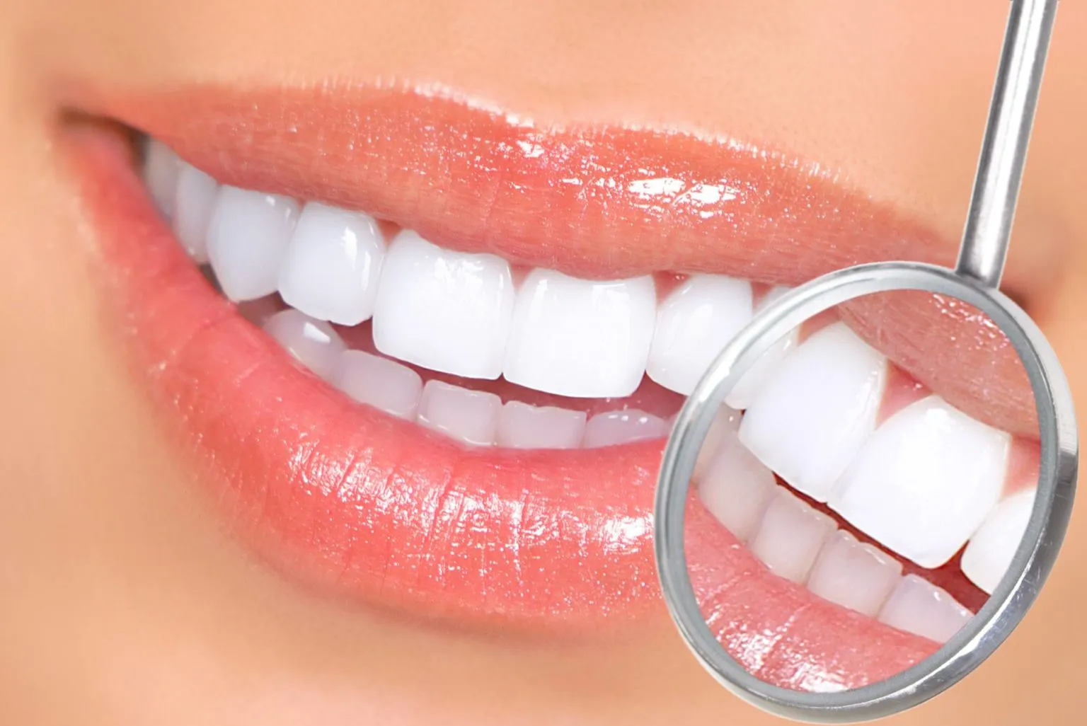 28015 professional teeth whitening