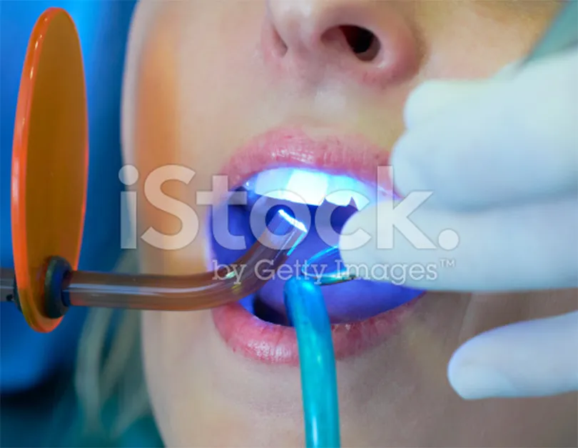 28016 teeth whitening consultation