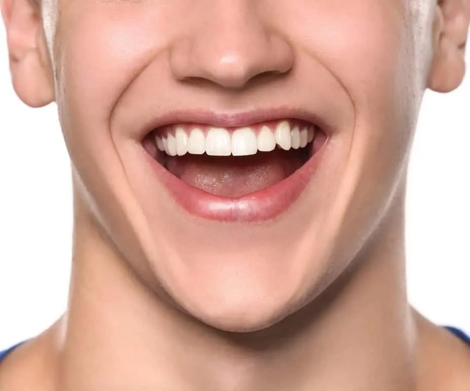 28022 tooth whitening portland or 5