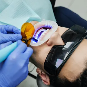 28026 tooth discoloration