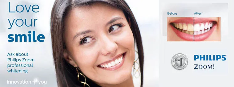 28031 teeth whitening alexandria mn 2