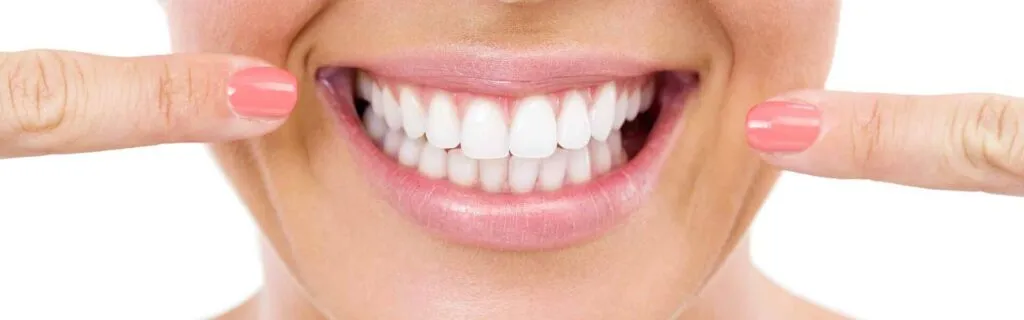 28031 teeth whitening alexandria mn 5