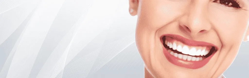 28031 teeth whitening alexandria mn 6