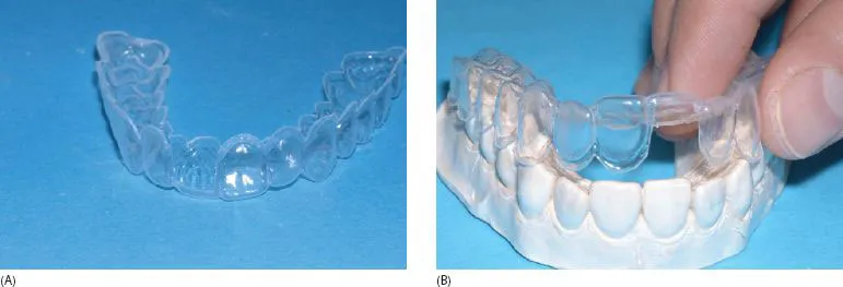 28046 cleaning teeth before whitening