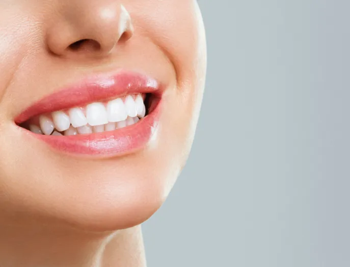 28055 teeth whitening mooresville nc image1