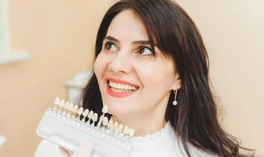 28056 teeth whitening at dentist 2