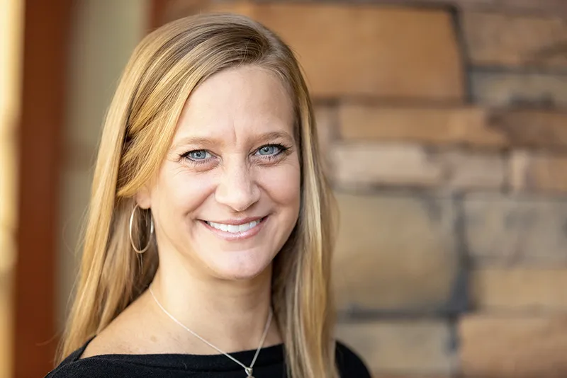 28059 over the counter whitening