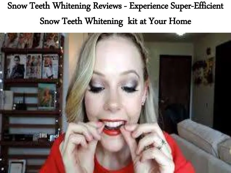 28065 teeth whitening results