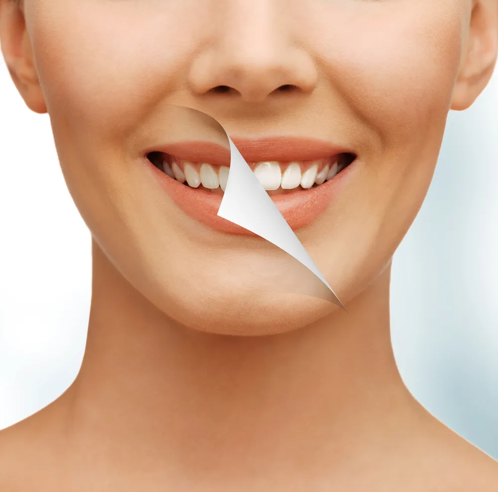 28067 teeth whitening kissimmee fl cost