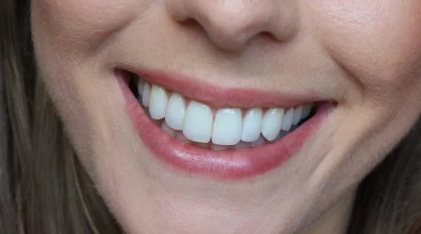 28069 crest whitening strips package