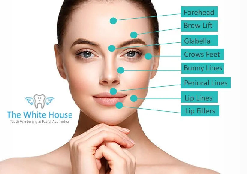 28075 teeth whitening offer