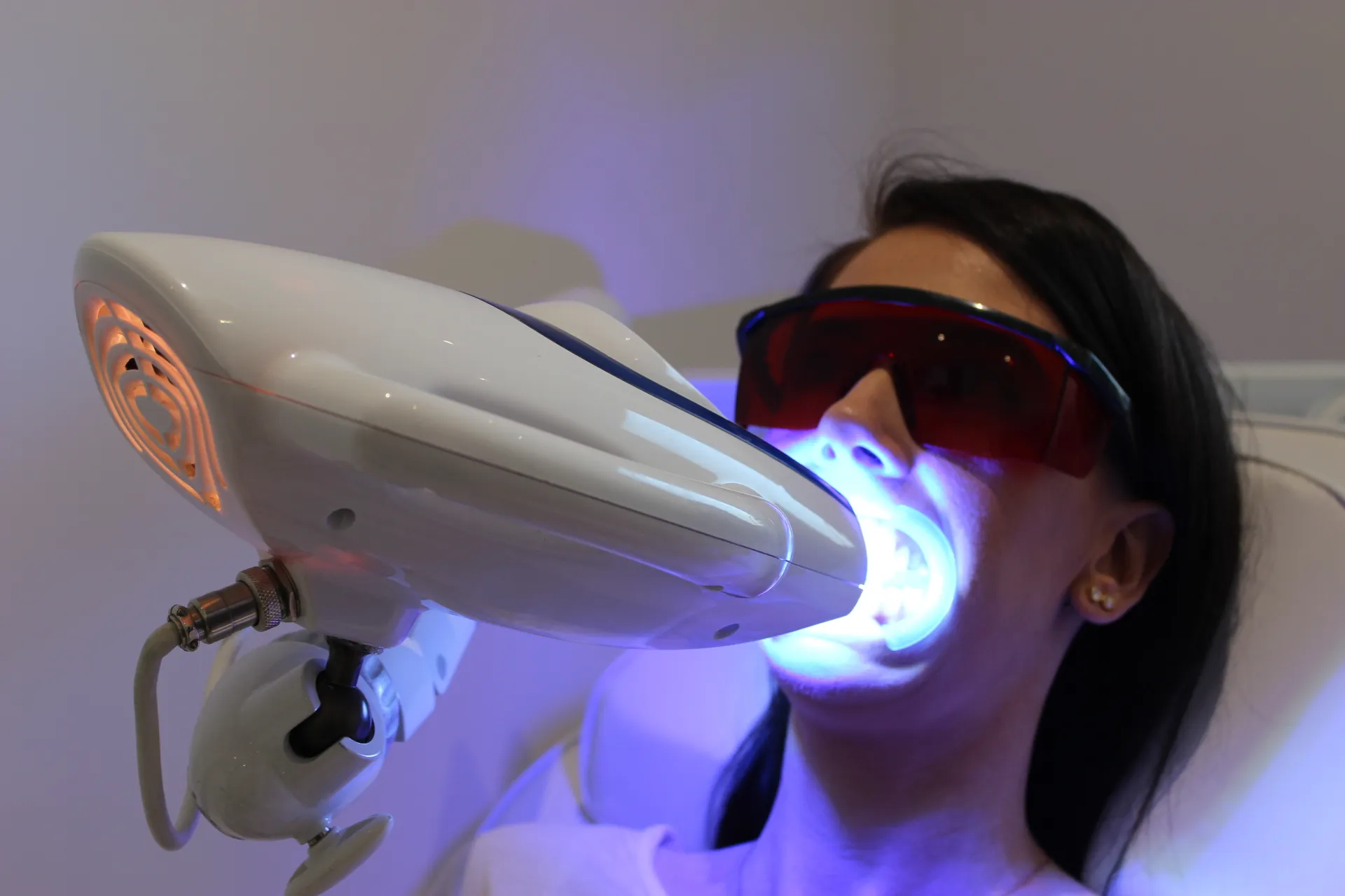 28075 teeth whitening procedure