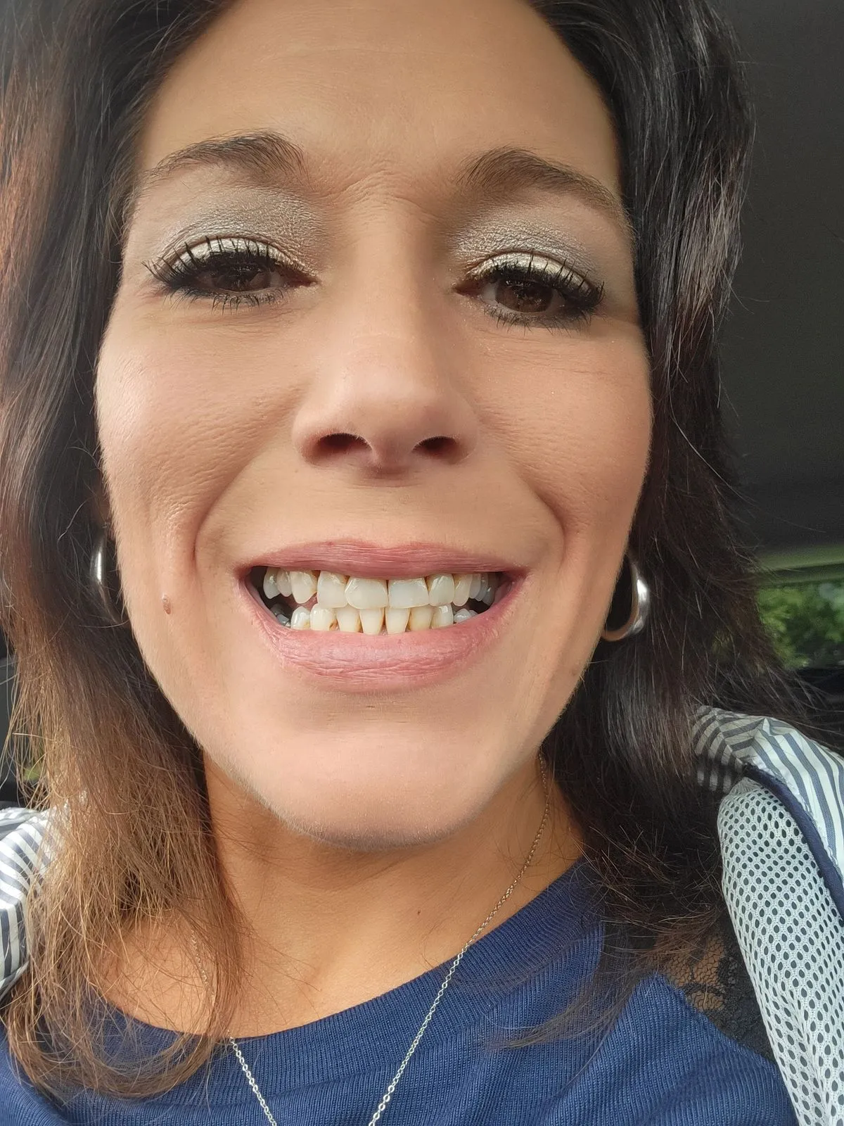 28077 snow teeth whitening booster