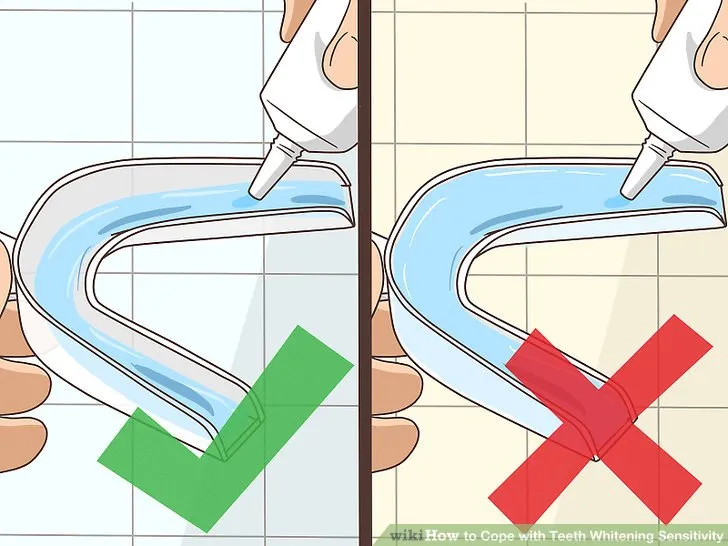 28078 teeth whitening sensitivity 6