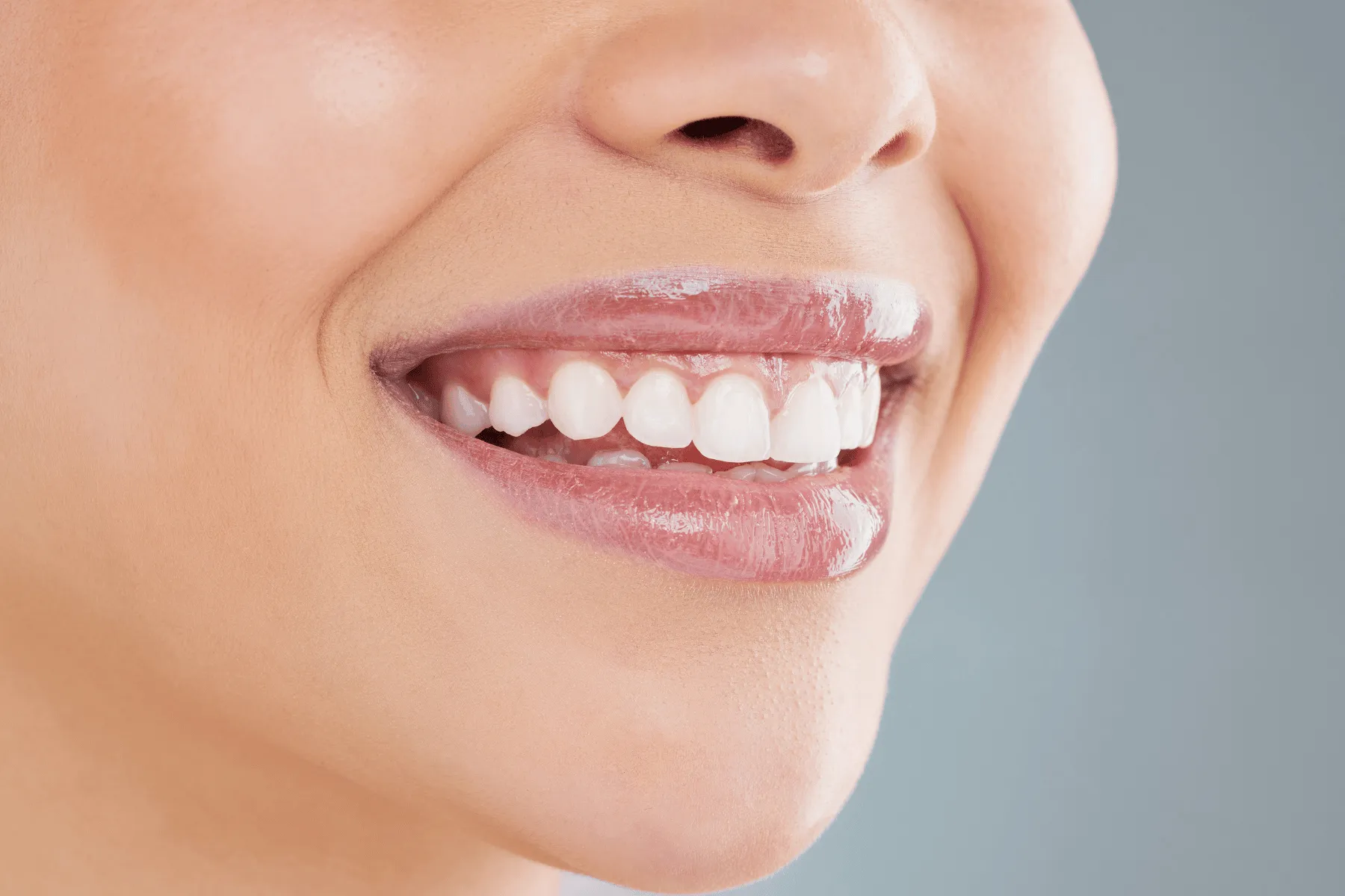 28081 teeth whitening kenmore confidence