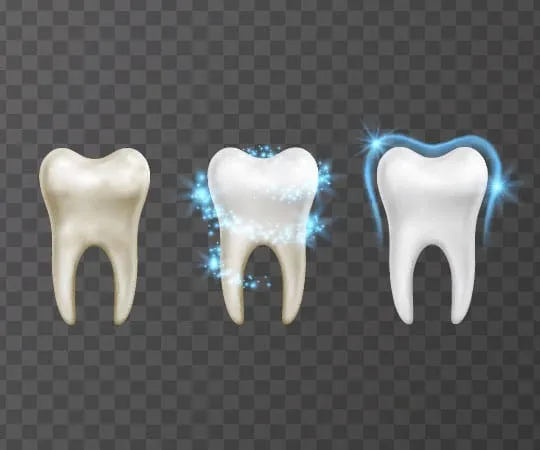 28104 teeth whitening options