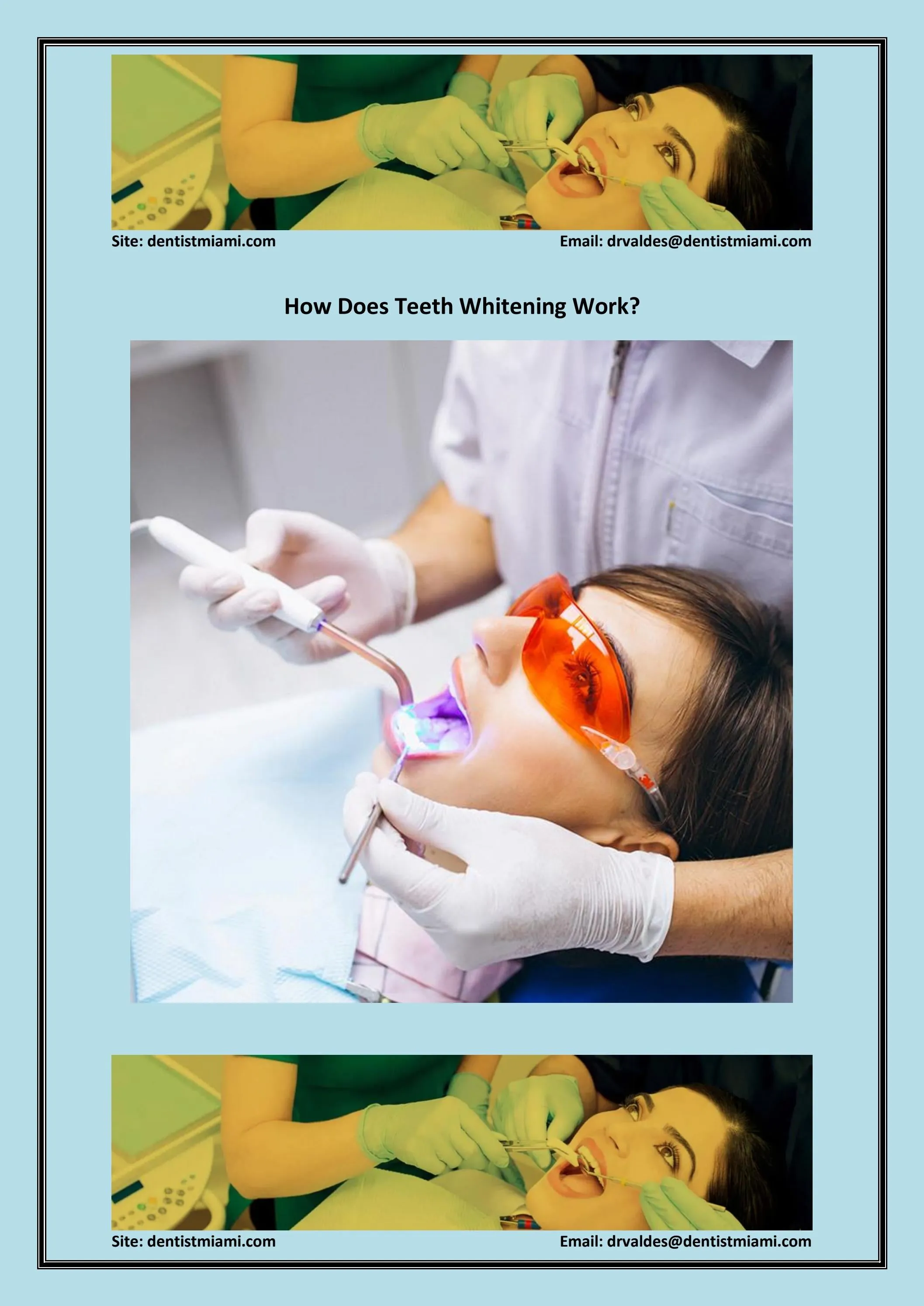 28107 teeth whitening aftercare