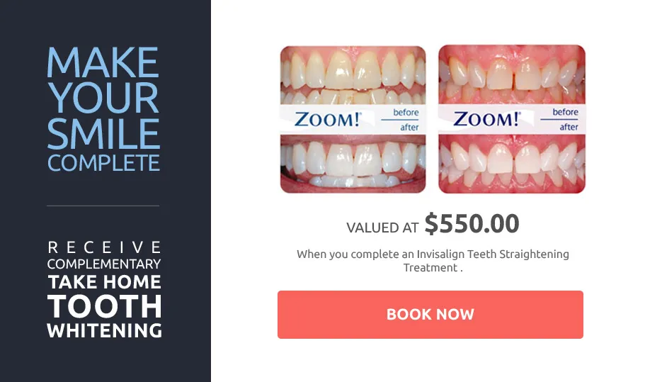 28109 teeth whitening treatments