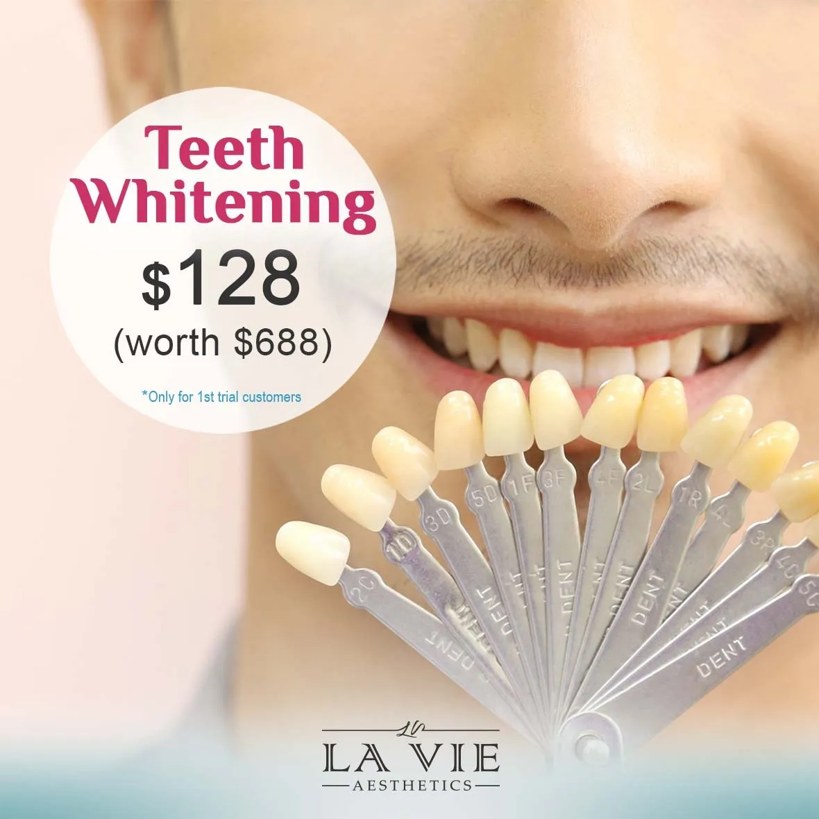 28118 teeth whitening la habra ca before after