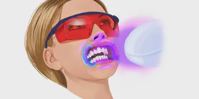 /img/28119-teeth-whitening-alternatives.webp